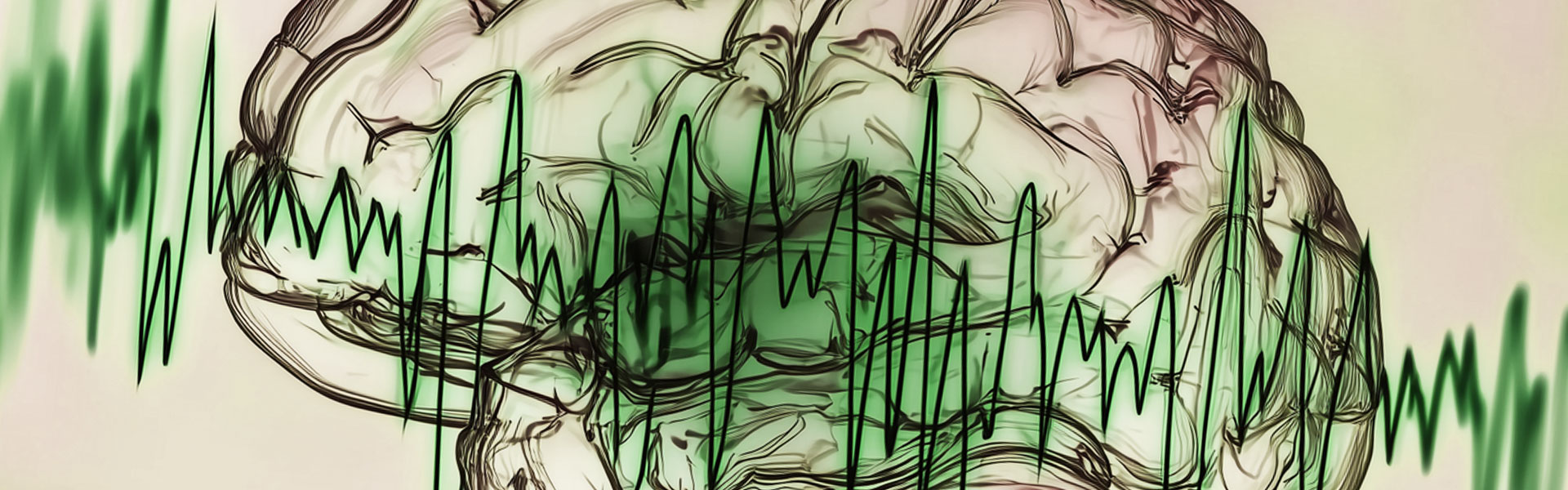 Epilepsy