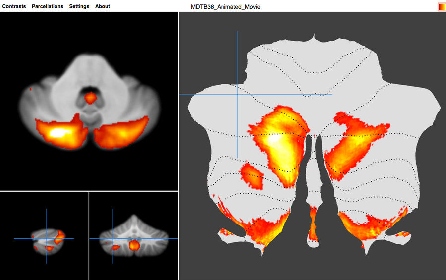 Functional atlas of the brain's cerebellum