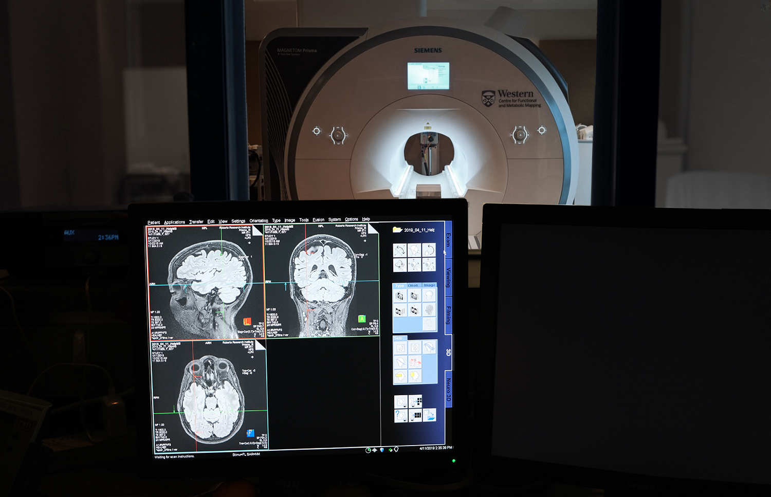 CFMM 3T Scanner