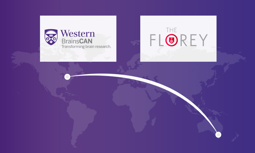 Western BrainsCAN and The Florey sign a new memorandum of understanding (MOU).