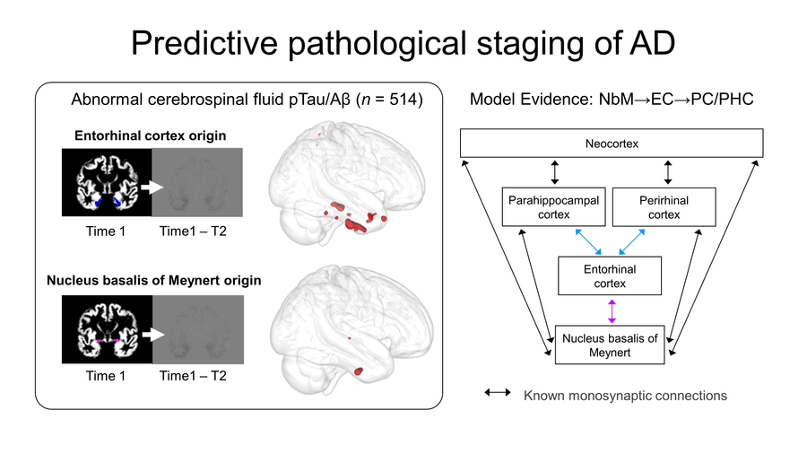 Predictive pathological staging of Alzheimer's Disease