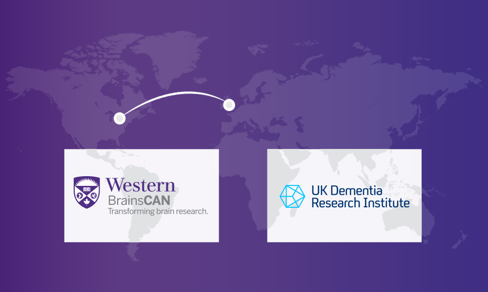 BrainsCAN partners with the UK Dementia Research Institute Ltd. (UK DRI).