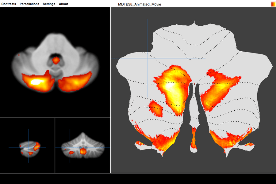 Functional atlas of the brain’s cerebellum