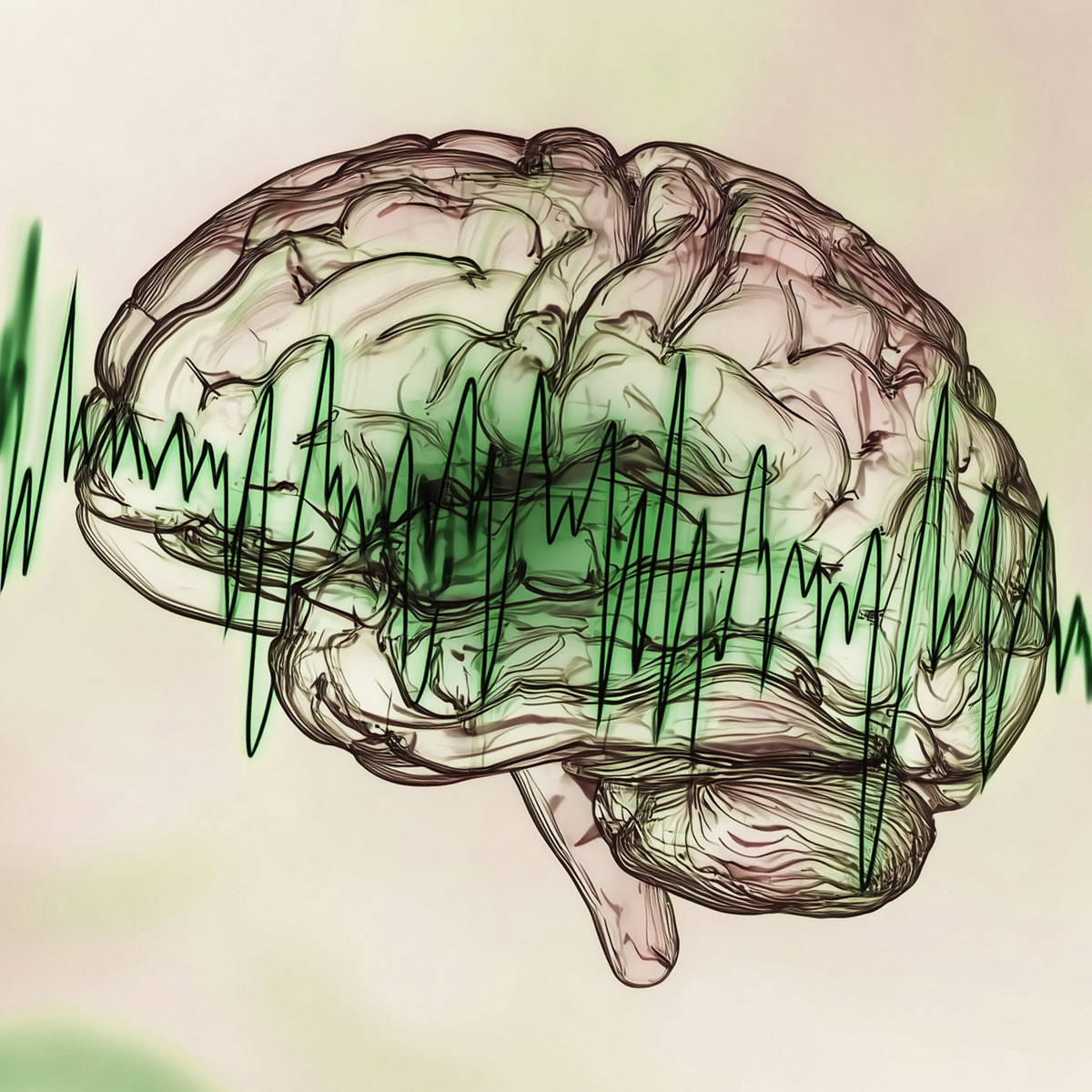 Epilepsy