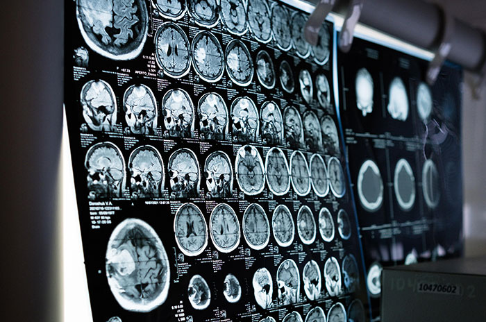 A technologist helping someone into an MRI machine