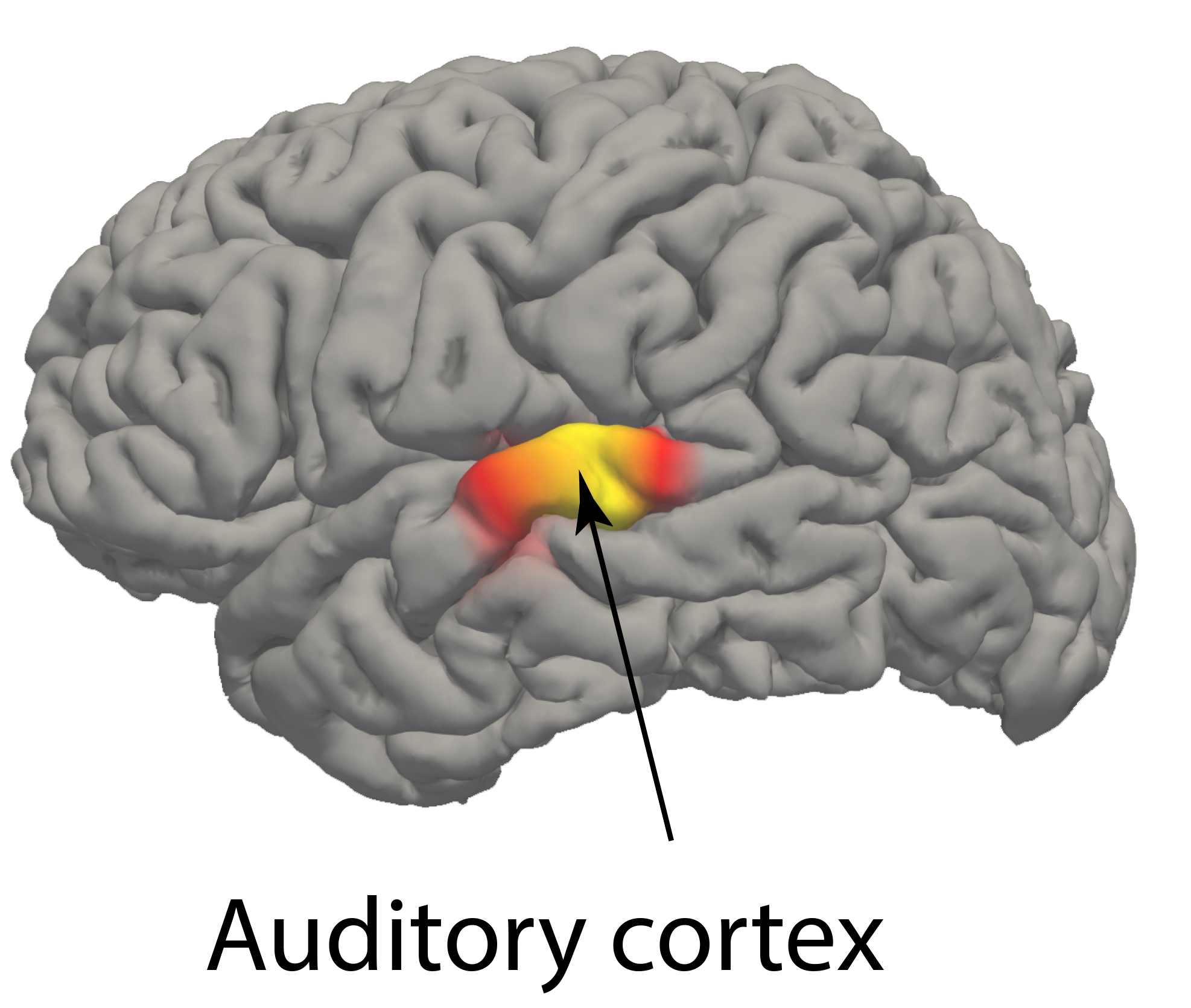 Auditory cortex
